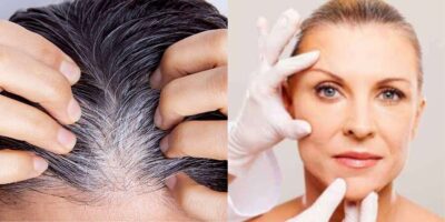 Fim dos cabelos brancos e das rugas com essas receitas incríveis (Foto: Internet)
