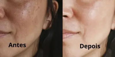 Fim de olheiras e manchas no rosto: Receita secreta com só 3 ingredientes traz pele de porcelana em 7 dias