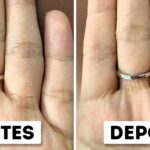 Tratamento caseiro para as mãos ressecadas (Foto: Reprodução/ Internet)