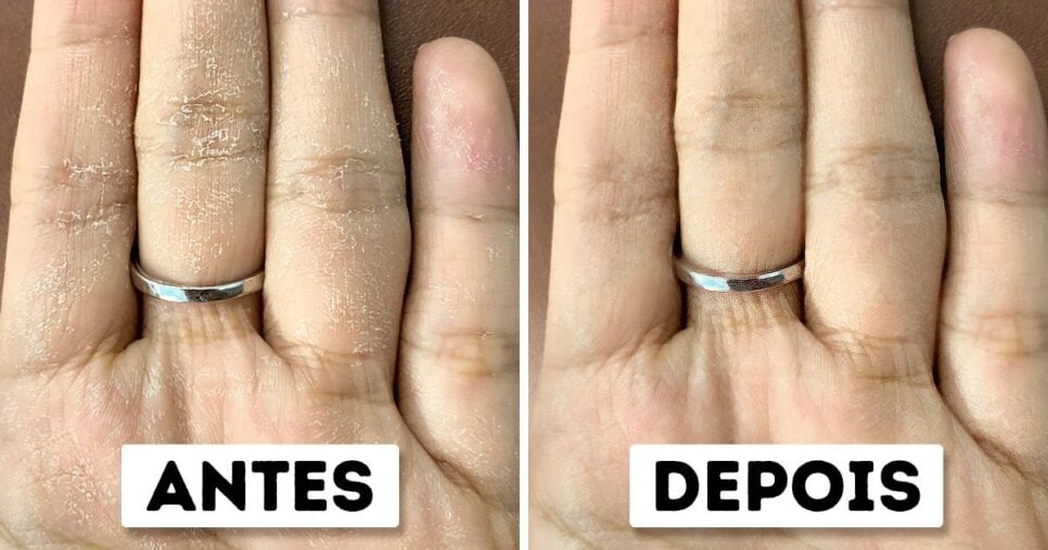 Tratamento caseiro para as mãos ressecadas (Foto: Reprodução/ Internet)