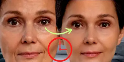 Fim do botox: Harmonização caseira transforma o rosto em 15 minutos e está deixando senhoras livres de rugas