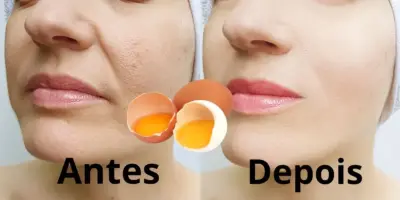Adeus rugas e pele lisa igual a de bebê: Melhor colágeno do mundo é caseiro e feito com clara de ovo em minutos