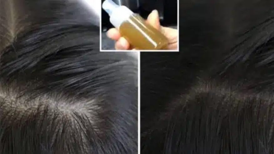 Tônico com semente de abacate para prevenir queda de cabelo (Foto: Reprodução / Informe Brasil)
