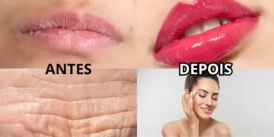 Fim do lábio rachado e rugas no frio: Único ingrediente natural deixa pele e boca lisinhas em 30 minutos