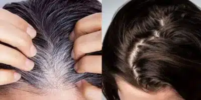 Imagem PreCarregada