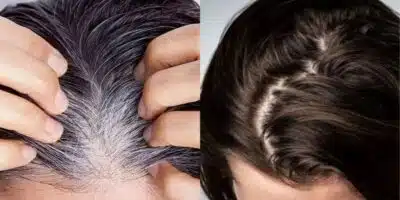 Imagem PreCarregada