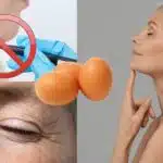 Mulher com papada, idosa com rugas e mulher tocando o pescoço (Fotos: Reproduções / Canva / Freepik / Internet) 
