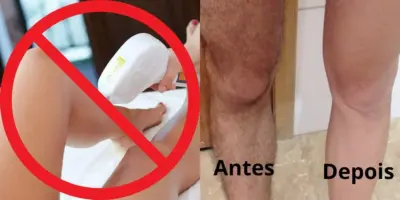 Fim da depilação à laser: Misturinha com maracujá e +1 item pra acabar com os pelos e ter pele de bebê