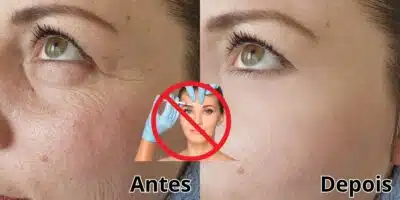 Imagem PreCarregada