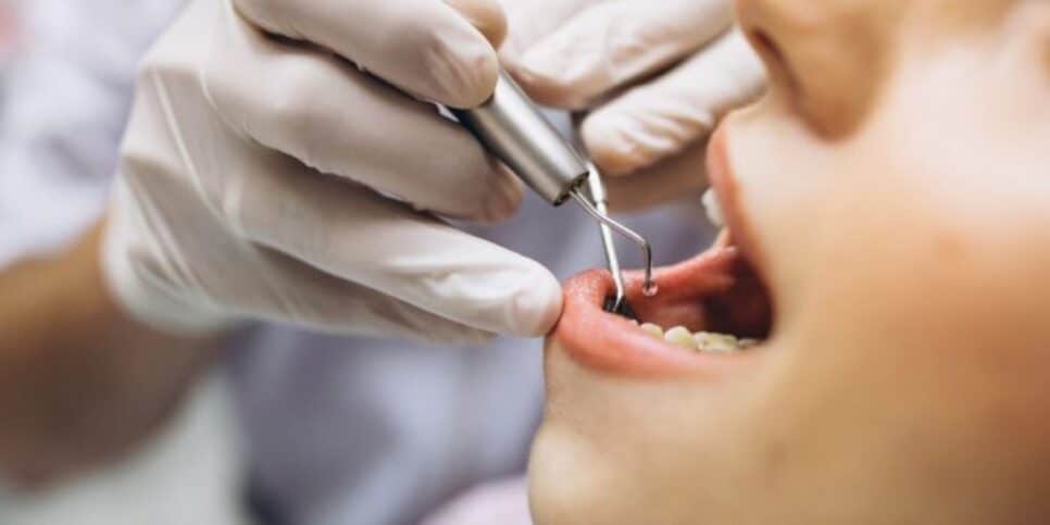 Vá de maneira constante, ao menos a cada 6 meses, para fazer a limpeza (Reprodução: Internet)