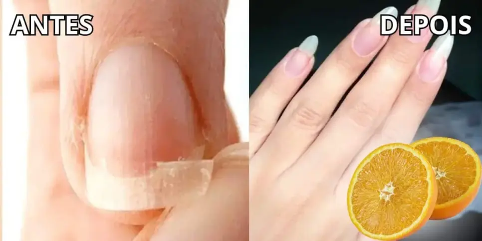 Conheça essa receita caseira incrível para ter unhas mais longas Conheça essa receita caseira incrível para ter unhas mais longas