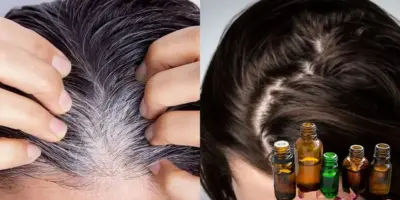Fim grisalho e queda: 2 óleos naturais eliminam o cabelo branco e fazem idosas 60+ pouparem rios de dinheiro