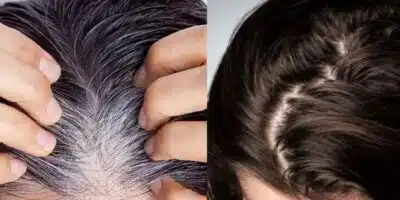 Imagem PreCarregada