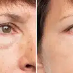 Harmonização natural com 3 produtos suga rugas cravando o fim do botox (Foto: Reprodução/ Internet)