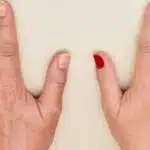 Mistura com 3 ingredientes dá adeus ao ressecamento e aos calos nas mãos (Foto: Reprodução/ Internet)
