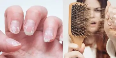 Unhas inquebráveis e fim da queda de cabelo: Suco traz colágeno mais potente do mundo com 2 ingredientes