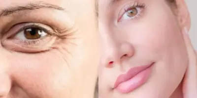 Substituto do botox: Único ingrediente de cozinha elimina rugas e traz pele de porcelana às mulheres 40+