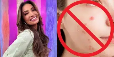 Patrícia Poeta ensinou máscara para acabar com espinhas e ressecamento (Reprodução: Montagem TV Foco)