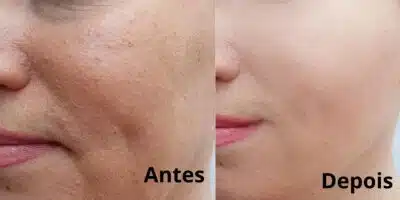 Imagem PreCarregada