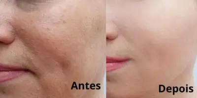 Harmonização caseira sem gastar 1 real: 3 ingredientes para rejuvenescer enquanto dorme