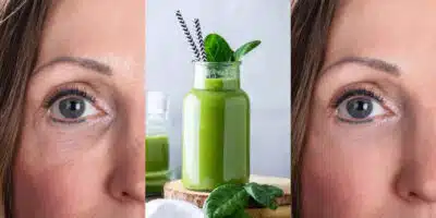 Adeus a rugas com esse suco milagroso (Foto: Divulgação)