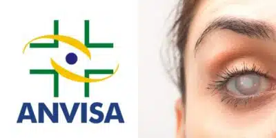 A proibição imediata da Anvisa contra produto popular entre as mulheres - (Foto: Montagem / TV FOCO)