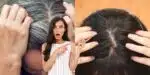 Acabe com o cabelo grisalho com 2 ingredientes (Reprodução: Montagem TV Foco)