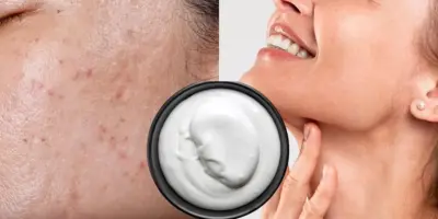 Fim das rugas, oleosidade e cravos: Botox caseiro com 2 ingredientes traz pele de porcelana em 30 minutos
