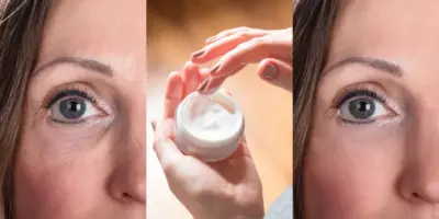 Fim das rugas com segredo das japonesas: Botox natural com azeite traz pele lisinha e rejuvenesce 30 anos