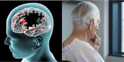 Atenção: Alerta urgente acaba de chegar com sinal inconfundível que detecta Alzheimer a partir dos 40 anos