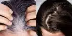 Fim do grisalho sem tinta para deixa o cabelo moreno (Foto: Reprodução, Montagem - TV Foco)