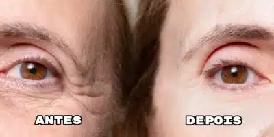 Adeus as rugas com essa receita infalível (Foto: Montagem)