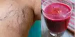O suco milagroso com único ingrediente popular que suga varizes das 55+ - Foto: Montagem
