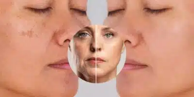 Imagem PreCarregada