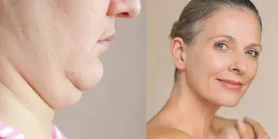 Produto mais usado por mulheres traz envelhecimento em dobro, aumenta papada e alerta está feito