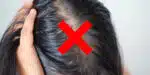 Cabelo oleoso com simples ingrediente natural (Foto: Divulgação)