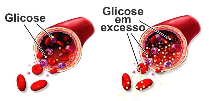 Glicose em excesso apresenta perigos á saúde (Foto Reprodução/YT)