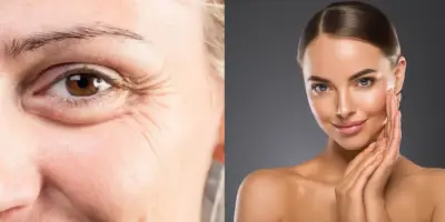 Botox natural: Mistura com 3 ingredientes suga rugas e deixa idosas 60+ com rostinho de 25