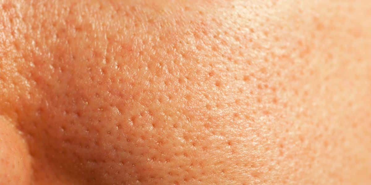 Poros dilatados http://tvfoco.uai.com.br/wp-content/uploads/2015/05/Daniela-Mercury.jpg