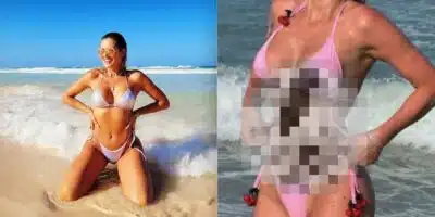Lívia Andrade faz lipo led e antes e depois choca internautas (Reprodução/Montagem/Instagram/Canva)