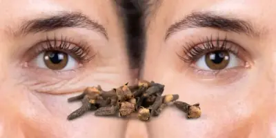 Receitinha caseira de 5 ingredientes com cravo dá fim em rugas e adeus ao botox