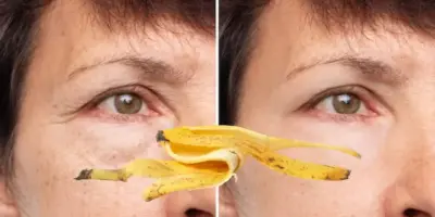 Tchau botox: 2 ingredientes, sendo um deles a casca de banana, dão fim definitivo nas rugas