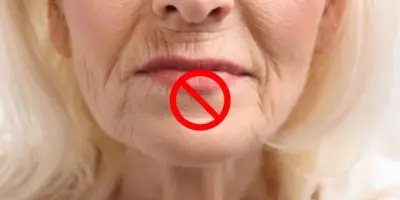 Tchau, bigode chinês: Com apenas 4 ingredientes você faz máscara caseira para acabar com as rugas