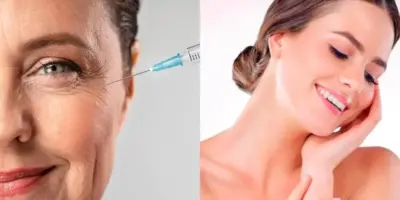 Melhor que botox: Creme antirrugas caseiro elimina às rugas e deixam às 50+ com pele de porcelana