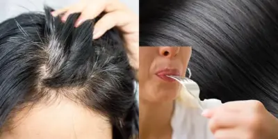 6 ingredientes de cozinha paralisam o surgimento do grisalho e ressuscitam o cabelo