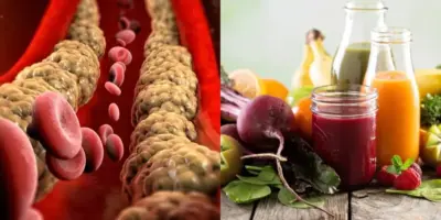 Suga a gordura do sangue: Suco milagroso com 2 ingredientes populares aniquila o colesterol das 60+