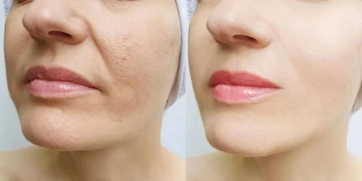 harmonização-facial http://tvfoco.uai.com.br/wp-content/uploads/2015/05/Daniela-Mercury.jpg