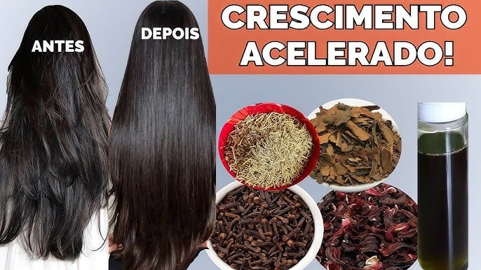 Tônico de alecrim promove crescimento acelerado (Foto Reprodução/YT)