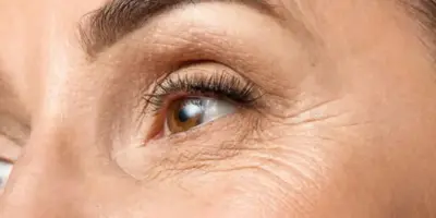 Mais potente que botox: Mistura caseira com 4 ingredientes dá fim as rugas e rejuvenesce as 50+