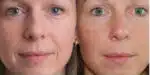 Adeus as rugas com esse antirrugas totalmente natural (Foto: Freepik)